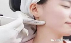 注射瘦脸打几次能定型？打注射瘦脸会反弹吗？ width=