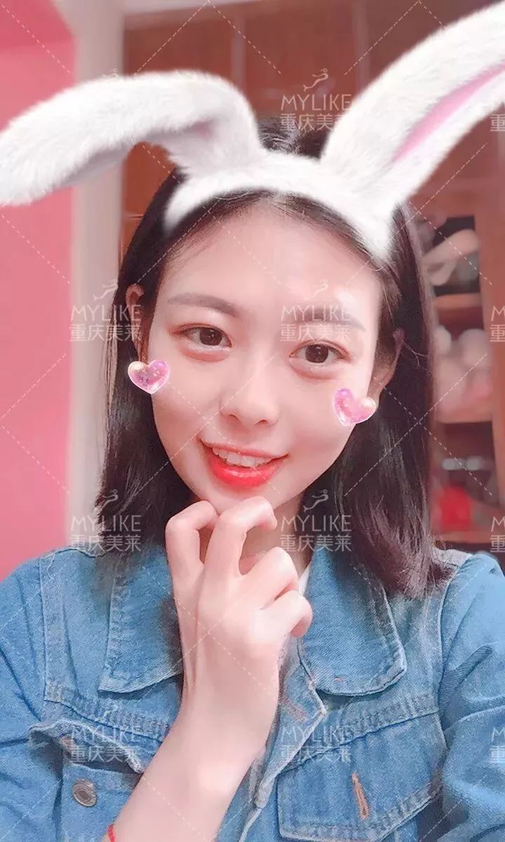 磨颧骨前后对比图，颧骨整形有失败案例吗？