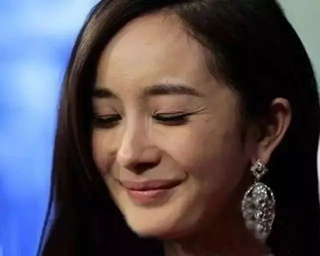 【OPT光子嫩肤脱毛是啥玩意儿？OPT光子嫩肤脱毛好吗？】