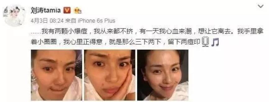 【OPT光子嫩肤脱毛是啥玩意儿？OPT光子嫩肤脱毛好吗？】