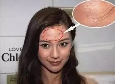 【OPT光子嫩肤脱毛是啥玩意儿？OPT光子嫩肤脱毛好吗？】
