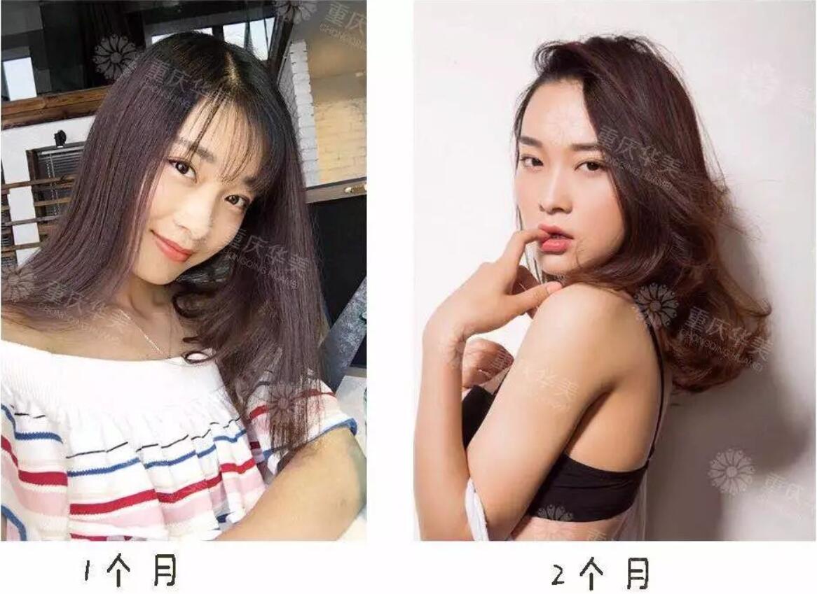 光魔动力分层祛斑：脸上有斑的女生，小心30岁的时候颜值崩掉！