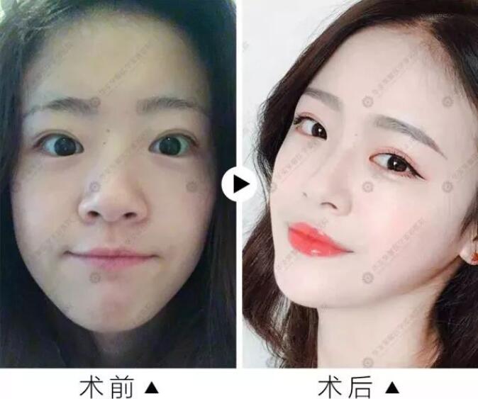 只是过了个新年，就换了张脸！
