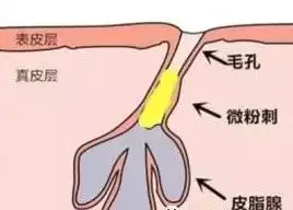 素颜被全网diss后，林允一气之下去医院整形！