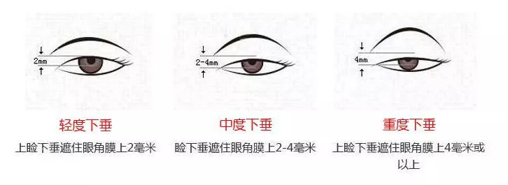大幂幂力捧95后校花遭吐槽，这双星星眼明明很迷人呀！ 
