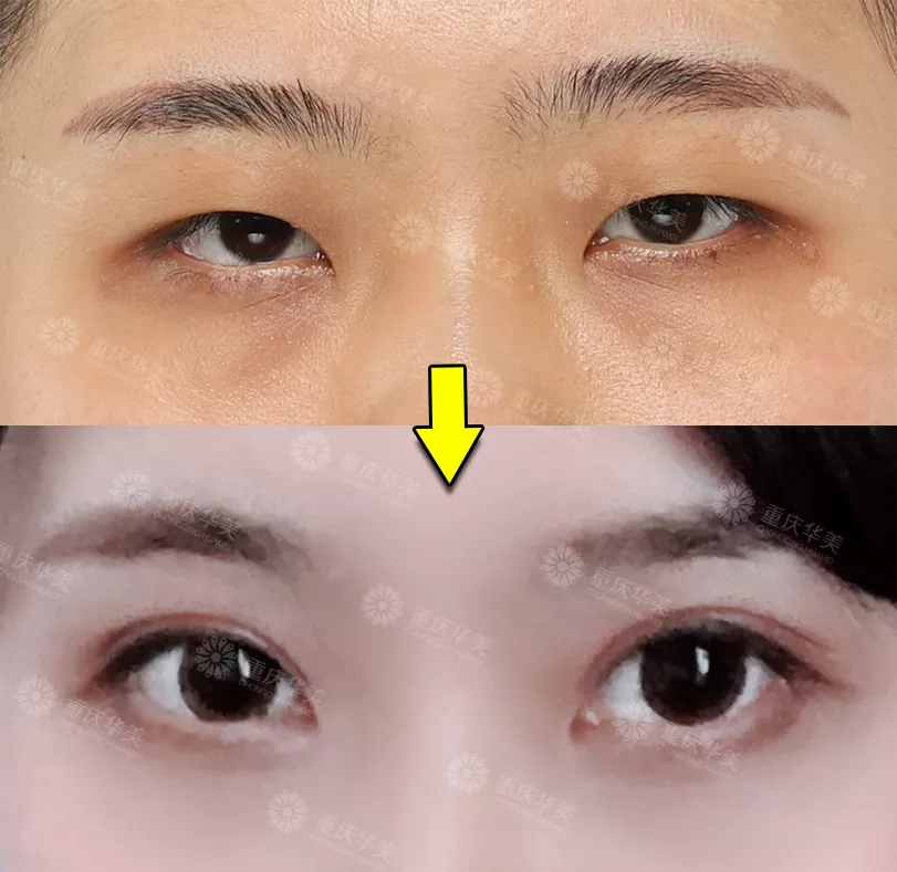大幂幂力捧95后校花遭吐槽，这双星星眼明明很迷人呀！ 