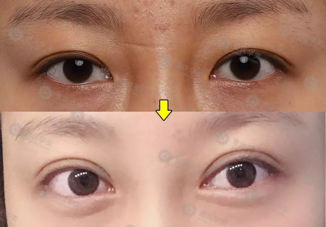 大幂幂力捧95后校花遭吐槽，这双星星眼明明很迷人呀！ 
