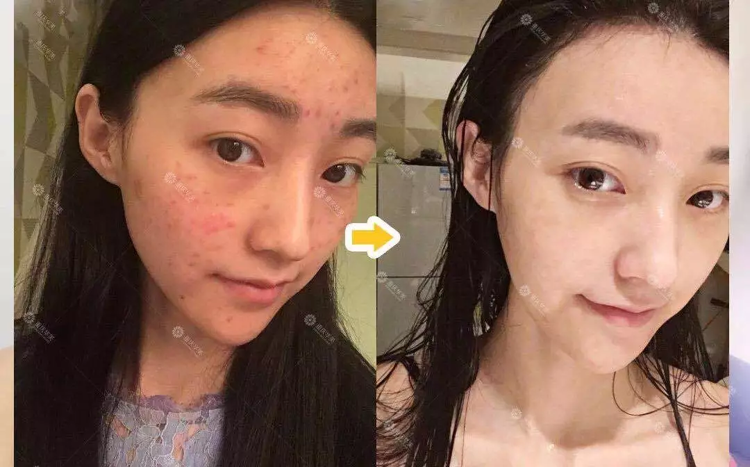47岁的闫妮中年逆袭颜值爆表，学会这些你也可以.....