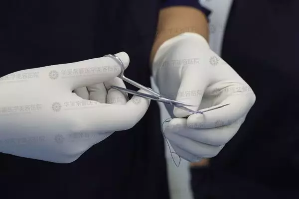 面部埋线提升提拉果好吗？面部埋线提升提拉果对比图~