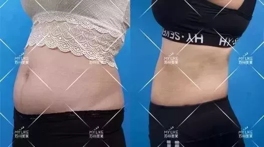 不要用“饭后一杯酸奶”来麻醉自己！