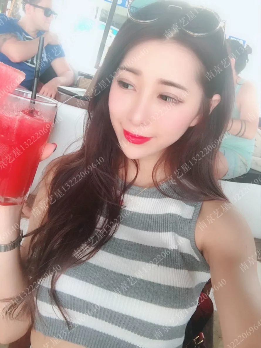 水滴型假体隆胸一个月果照片——南京艺星真实案例~