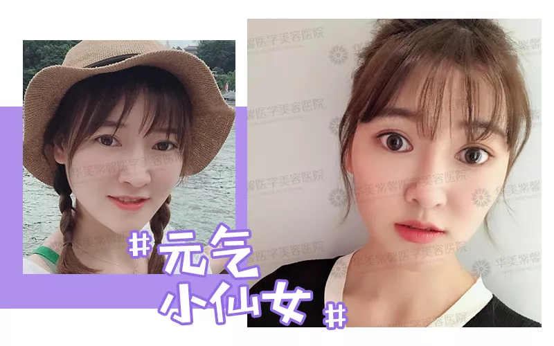 12头身漫画版美少女，整容换头后丑得看不下去？！