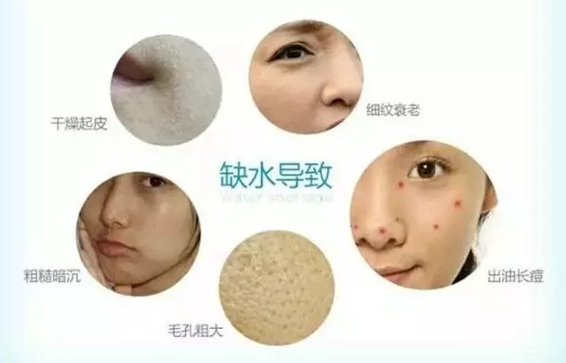 “劫”后余生，小V让你开工满血复活！