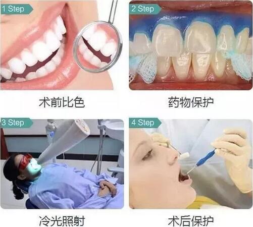 牙齿黄，涂再贵的口红也不好看！