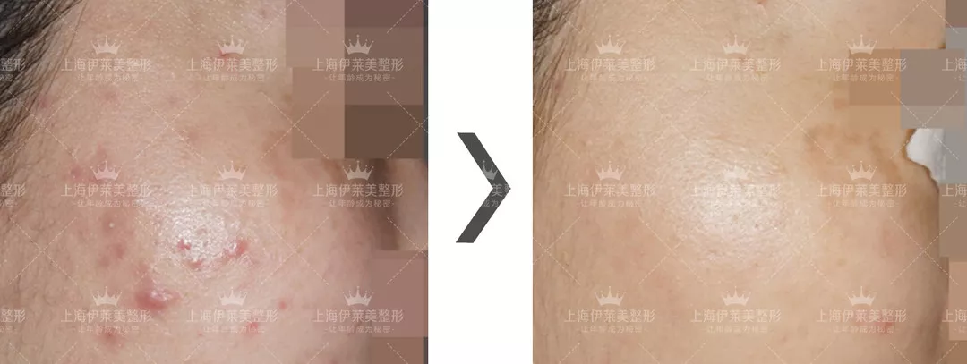 上海伊莱美整形医院有一份情人节攻略，请您注意查收~