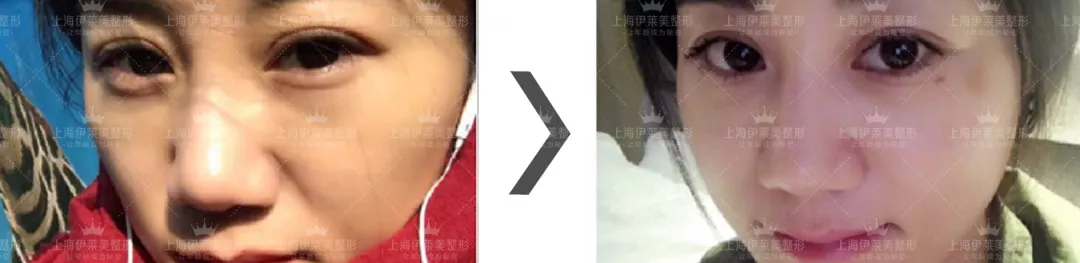 上海伊莱美整形医院有一份情人节攻略，请您注意查收~