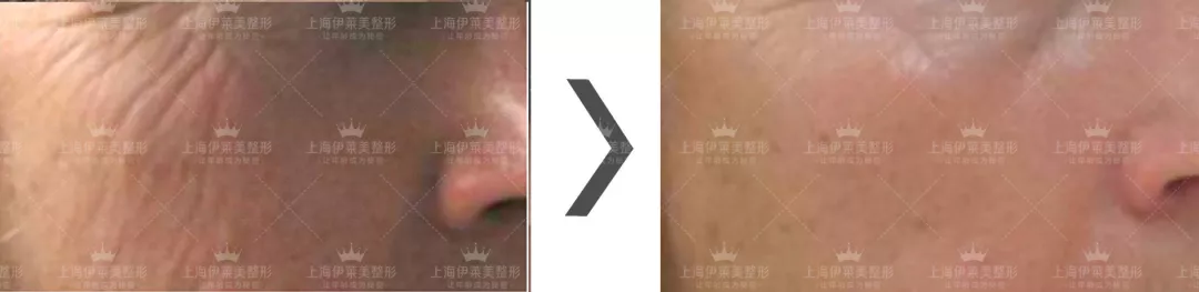 上海伊莱美整形医院有一份情人节攻略，请您注意查收~