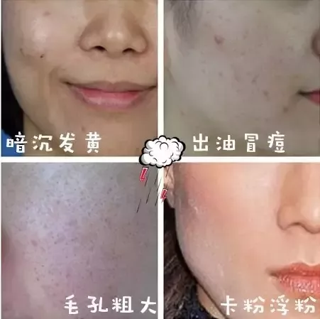 水光补水多少钱？法国抗衰产品+激光美肤激光祛斑果图一览~