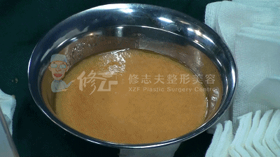 每逢佳节如何瘦三斤？