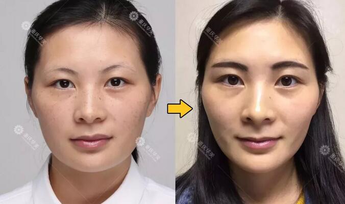她祛斑get大白皮！你祛斑毁脸？区别就在这几点~