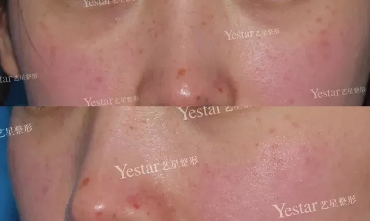 刚离婚的她曝光恋情？这张脸...想单身都难！