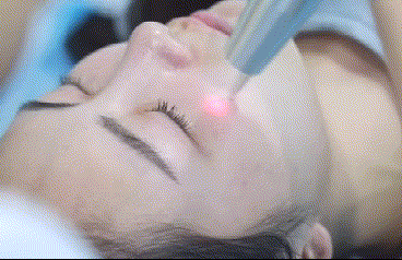 激光美肤激光祛斑好吗？激光美肤激光祛斑案例有没有给看一看~