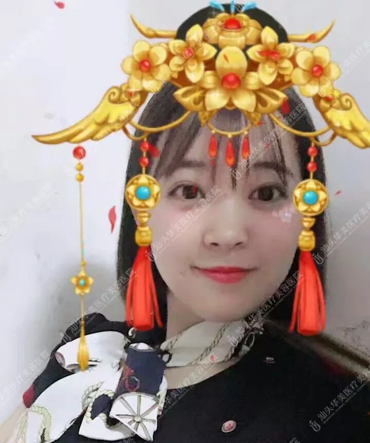 激光美肤激光祛斑好吗？激光美肤激光祛斑案例有没有给看一看~