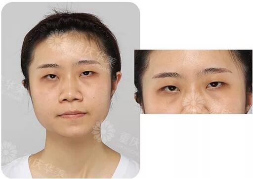 元气女神陈yi涵产子，那双青春厉害的双眼皮终于后继有人啦~