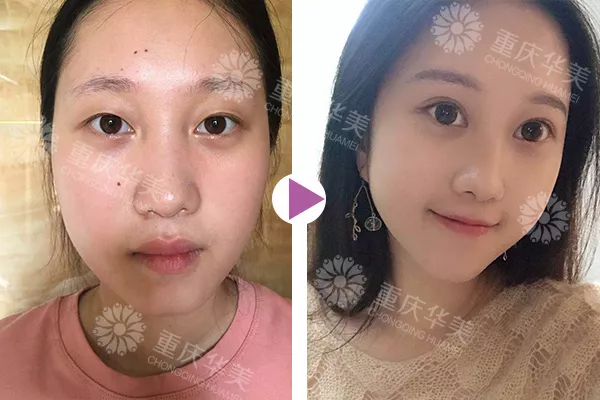 元气女神陈yi涵产子，那双青春厉害的双眼皮终于后继有人啦~