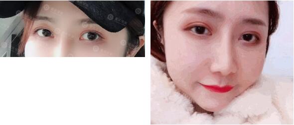 元气女神陈yi涵产子，那双青春厉害的双眼皮终于后继有人啦~