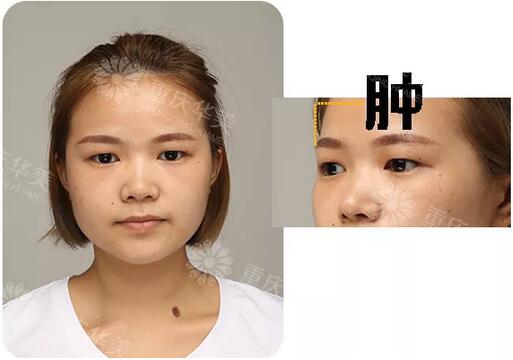 元气女神陈yi涵产子，那双青春厉害的双眼皮终于后继有人啦~