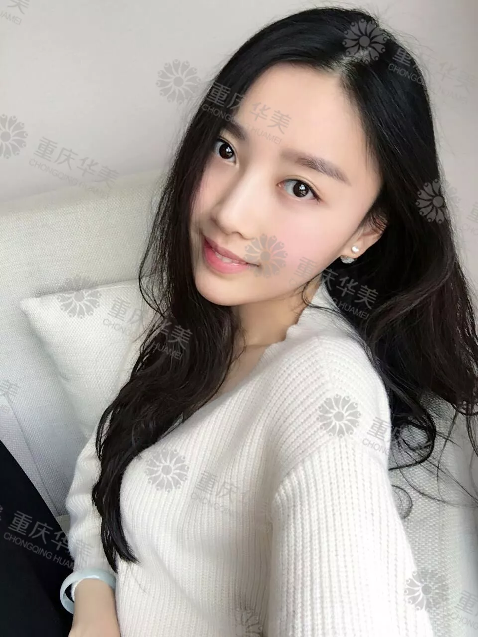 改造奚梦瑶同款凹陷脸，怎样填充得不露痕迹？