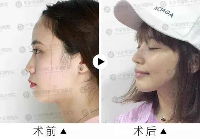 Baby同款犬系脸长我脸上，为啥我没有她好看呢？