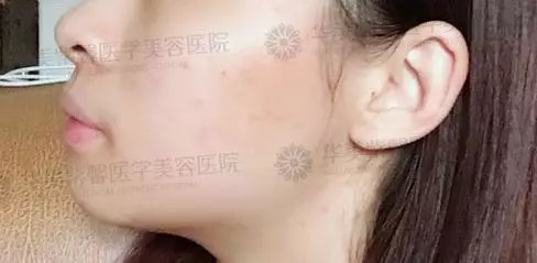 Baby同款犬系脸长我脸上，为啥我没有她好看呢？