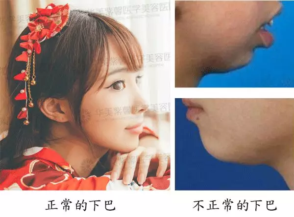 Baby同款犬系脸长我脸上，为啥我没有她好看呢？
