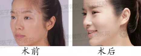 Baby同款犬系脸长我脸上，为啥我没有她好看呢？