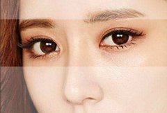 双眼皮那么多,要怎么知道适合哪种 width=