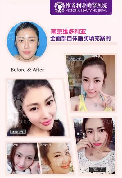 【Word~天~】每逢佳节胖三斤？吸出好身材，填出美颜来！