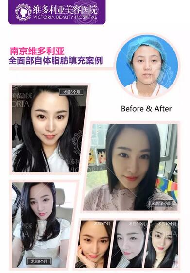 【Word~天~】每逢佳节胖三斤？吸出好身材，填出美颜来！