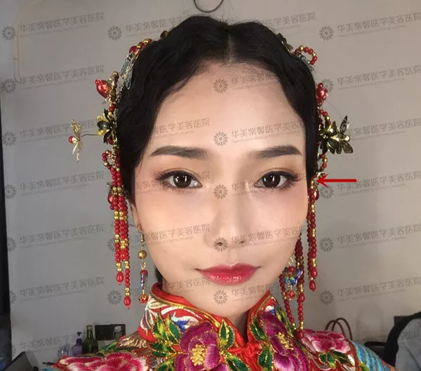 皇后脸蔡少芬戏路变窄，颧骨高如何改良？