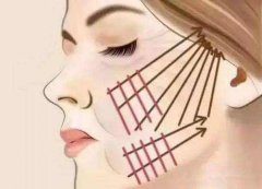 伊甸园魔力丝线艺术提拉系统 width=