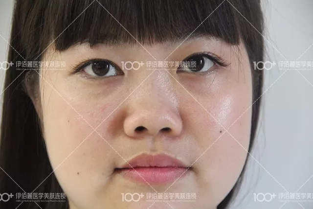 【明明就有桃花运，硬是被猪鼻子拖垮了好几年~】