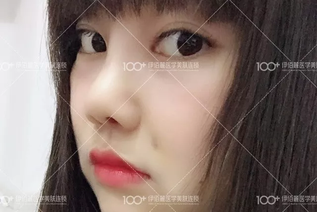 【明明就有桃花运，硬是被猪鼻子拖垮了好几年~】