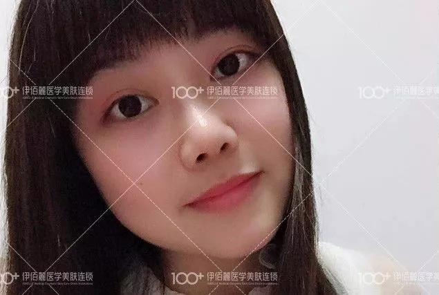 【明明就有桃花运，硬是被猪鼻子拖垮了好几年~】