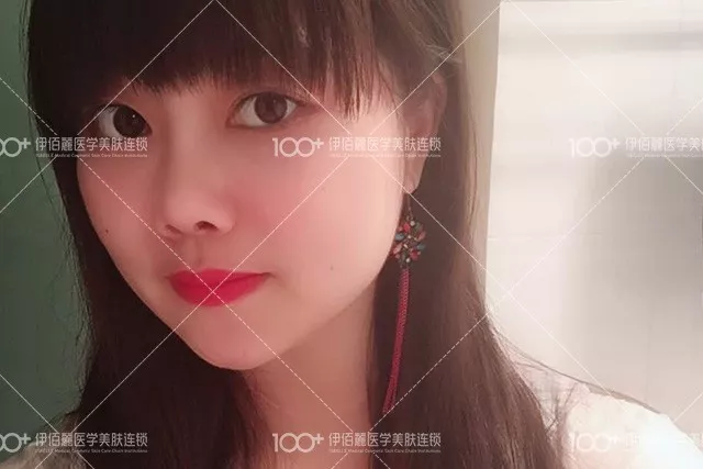 【明明就有桃花运，硬是被猪鼻子拖垮了好几年~】
