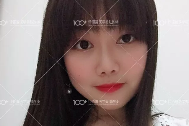 【明明就有桃花运，硬是被猪鼻子拖垮了好几年~】