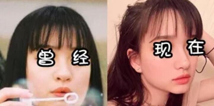 当红流量比不过假脸网红？她被爆以前长这样！
