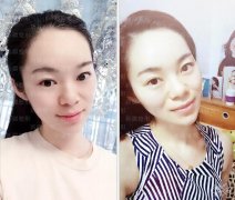 人工植发多少钱？有危害吗？什么问答都可以来问我哦~ width=