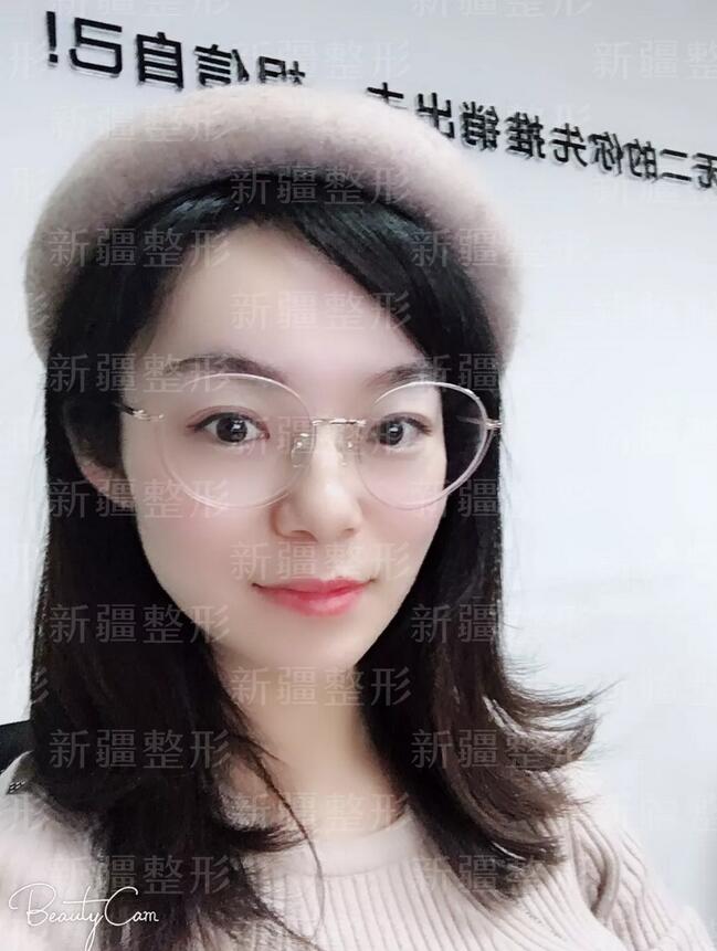 人工植发多少钱？有危害吗？什么问答都可以来问我哦~