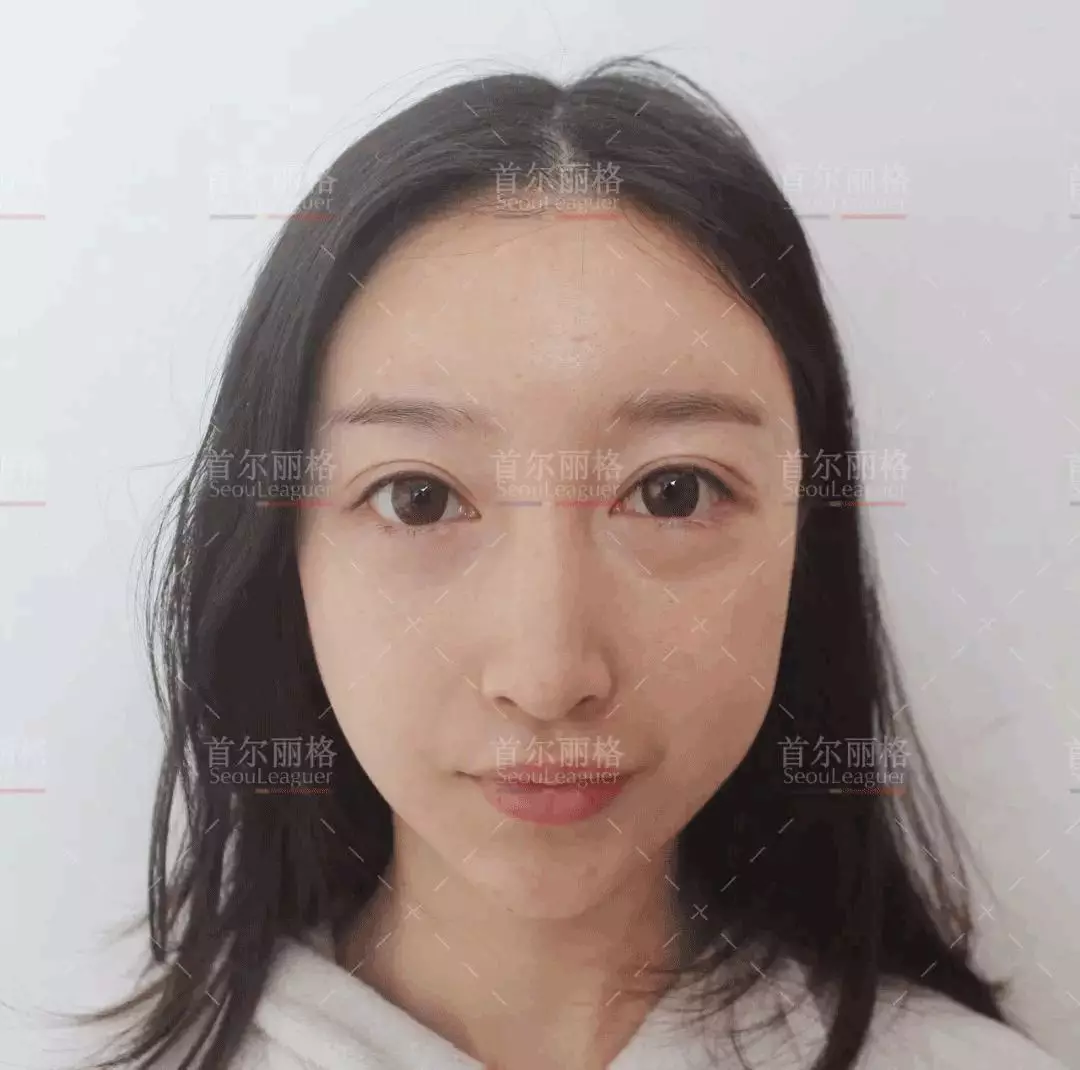 眼袋变卧蚕，来，感受下小姐姐的惊鸿一瞥！